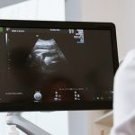 obesity gyno